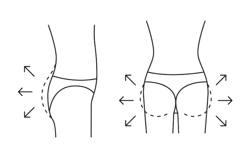 Brazilian Butt Lift